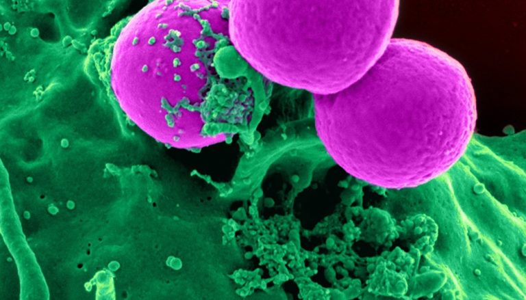 Vue au microscope de bactéries, un des contaminants possibles de l'eau potable
